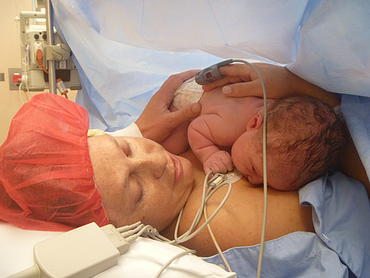 Caesarean, Birth Choices in WA, Hypnobirthing in Perth, doula in Perth, hypnobirthing, childbirth educator, Vicki Hobbs, doula, birth without fear, natural birth, pregnancy massage in Perth, induction, 