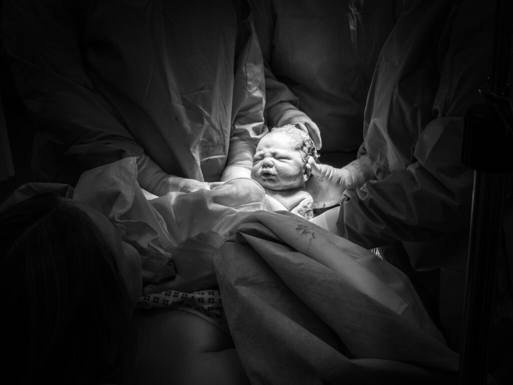 caesarean birth in Perth, Back to Basics Birthing, c-section, caesarean, cesarean, Hypnobirthing Australia Positive Caesarean Course, change of circumstances birth