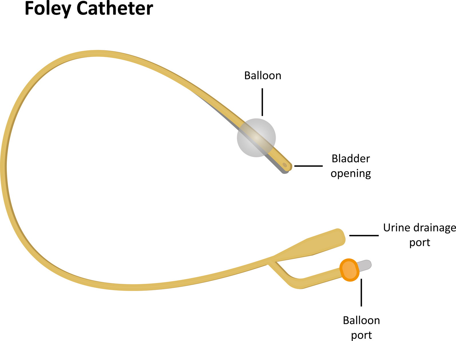 Как ставят катетер в мочевой пузырь